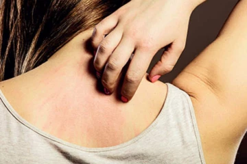 சொறி, சிரங்கு, படை போன்றவற்றை அடித்து விரட்டும் தைலம்... எப்படி செய்வது தெரியுமா?