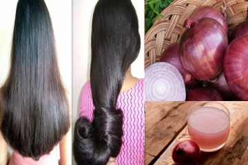 கூந்தல் முடியின் பிரச்சனைகளுக்கு வெங்காயச்சாறு தீர்வளிக்குமா?