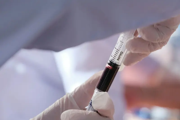 கருச்சிதைவு ஏற்பட்ட பெண்ணின் உடலில் ஆண் குரோமோசோம்கள்: வியப்பில் மருத்துவர்கள் | Male Chromosomes In Woman Blood After Miscarriage கருச்சிதைவு ஏற்பட்ட பெண்ணின் உடலில் ஆண் குரோமோசோம்கள்: வியப்பில் மருத்துவர்கள் | Male Chromosomes In Woman Blood After Miscarriage