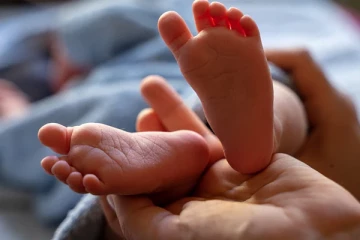 தலையும் வாயும் இல்லாமல் பிறந்த அபூர்வ குழந்தை!பரபரப்பை ஏற்படுத்திய சம்பவம் (Video)