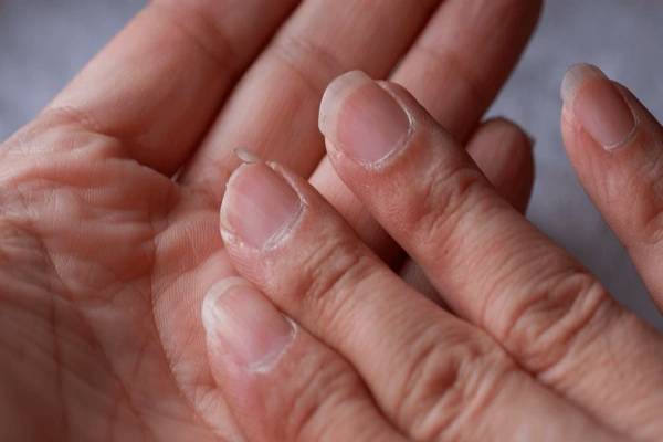 நீங்கள் எவ்வளவு காலம் வாழ்வீர்கள் என்று உங்கள் நகமே சொல்லும்... எப்படி தெரியுமா? | Your Nails Will Tell You How Long You Will Live