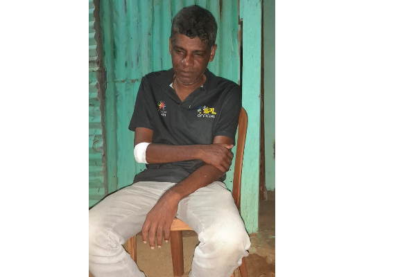 யாழில் புளொட் உறுப்பினர் மீது தாக்குதல்! (படங்கள்) | Attack On A Member Of The Bloat Organization