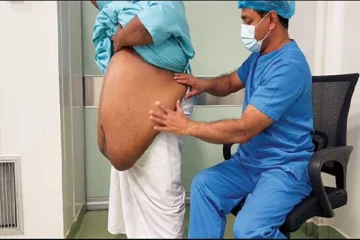 பெண்ணின் வயிற்றிலிருந்து அகற்றப்பட்ட பெருமளவு கொழுப்பு :இலங்கை மருத்துவர் சாதனை