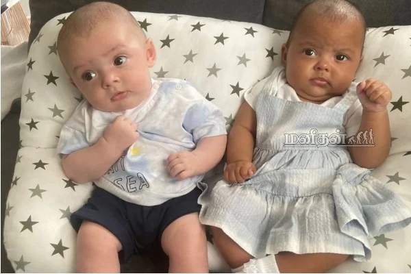 ட்ரெண்டான இரட்டை குழந்தைகள் -  குழப்பத்தில் தாய்! என்ன நடந்தது தெரியுமா? | Mum Stunned After Twins Born With Different