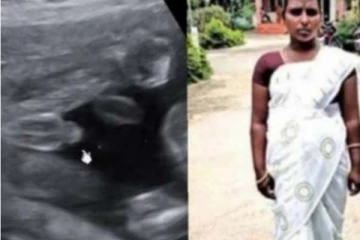 வயிற்றில் குழந்தை என 7 மாதமாக சிகிச்சையளித்த மருத்துவர்.. திடீரென ஏற்பட்ட வலி! ஸ்கேனில் தெரியவந்த அதிர்ச்சி உண்மை
