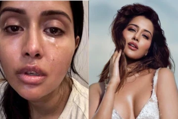 கண்கள் வீங்கி மோசமான நிலைக்கு தள்ளப்பட்ட ரைசா - திரைப்பிரபலங்கள் ஆறுதல்!