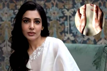 இரத்த காயங்களுடன் ரசிகர்களை ஓட விட்ட சமந்தா! அதிர்ச்சியில் இணையவாசிகள்