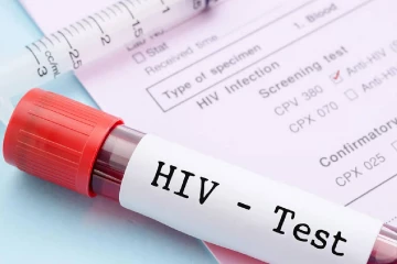 ලංකාවේ HIV ආසාදනය වෙන පිරිමින්ගේ භයානක ඉහළ යාමක් - කාන්තාවන් 1ට පිරිමි 7ක්