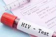 ලංකාවේ HIV ආසාදනය වෙන පිරිමින්ගේ භයානක ඉහළ යාමක් - කාන්තාවන් 1ට පිරිමි 7ක්