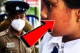 மன்னாரில் ஆசிரியை தாக்கியதில் தரம் 5 மாணவி வைத்தியசாலையில்!