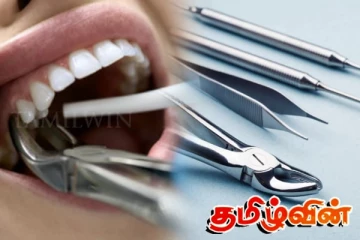 இலங்கை வைத்தியசாலையில் மற்றுமொரு சோகம் - பல் பிடிங்கிய யுவதி மரணம்