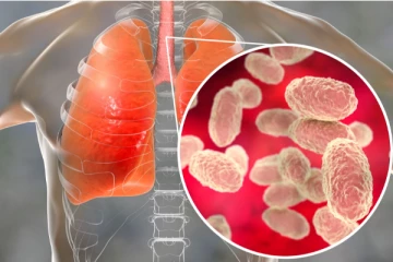 கனடாவின் இந்த மாகாணத்தில் தொடர் இருமல் நோய் அதிகரிப்பு