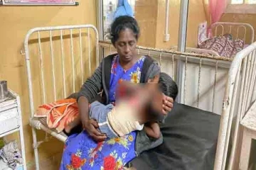 தந்தையின் கொடூர செயல் -மூன்று வயது குழந்தை மீது கொதிநீர் வீச்சு