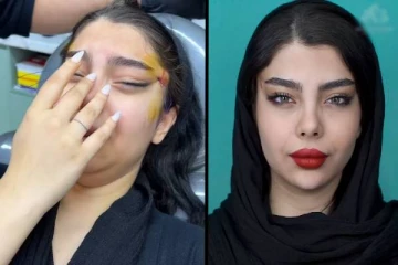 இளம் பெண்ணுக்கு வந்த ஆசை.. அறுவை சிகிச்சை கொடுத்த தீர்வு- இதெல்லாம் தேவையா?