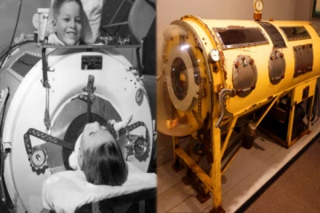 கோடிக்கணக்கானோர் சுவாசிக்க உதவிய கண்டுபிடிப்பு - இரும்பு நுரையீரல் பற்றி தெரியுமா?