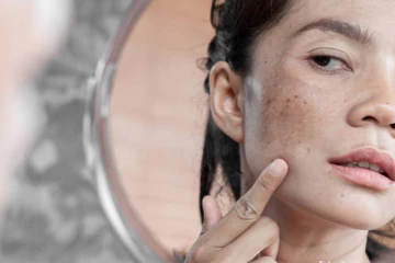 கரும்புள்ளி உங்கள் முகத்தை பாழாக்குதா? இதனை அடியோடு போக்க இதோ சூப்பரான டிப்ஸ்