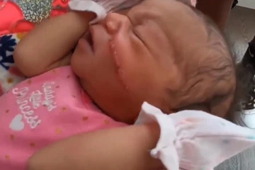 பிறந்த குழந்தையின் முகத்தில் 13 தையல்கள்: நெஞ்சைப் பிளக்கும் பின்னணி