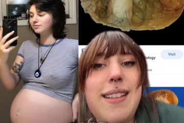 கர்ப்பமாக இருப்பதாக எண்ணிய பெண்... ஸ்கேனில் தெரிந்த அதிரவைத்த காட்சி