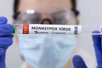 ரொறன்ரோ பிரஜைகள் குரங்குமை தடுப்பூசிக்காக முன்பதிவு செய்யலாம்