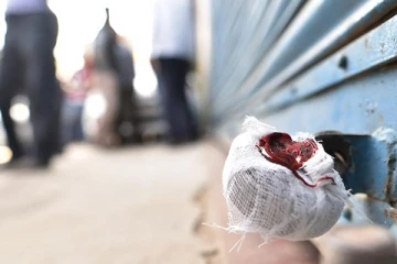 125 கடைகளுக்கு சீல் - சென்னை மாநகராட்சி அதிரடி!