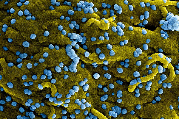 தேசத்தை உலுக்கும் கொடிய வைரஸ்; உயிரை கொல்லும் தீவிரம் - கிளம்பிய புது ஆபத்து | Marburg Virus That Spreads In Africa தேசத்தை உலுக்கும் கொடிய வைரஸ்; உயிரை கொல்லும் தீவிரம் - கிளம்பிய புது ஆபத்து | Marburg Virus That Spreads In Africa
