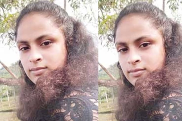 நாய் ஒன்றினால் பரிதாபமாக உயிரிழந்த யுவதி