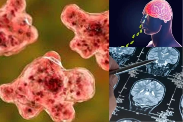 உயிர்பிழைக்க வாய்ப்பேயில்லை மூளையை உண்ணும் கொடிய அமீபா - கேரளாவில் அதிகரிக்கும் பாதிப்புகள்!!