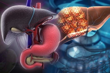 கல்லீரலில் கொழுப்பு படிந்திருந்தால் இந்த அறிகுறிகள் காட்டுமா?