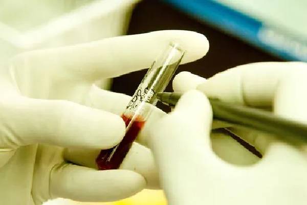 5 குழந்தைகளுக்கு HIV உறுதி - அதிர்ச்சி பின்னணி! | 5 Thalassemia Kids Jharkhand Tested Positive Hiv 5 குழந்தைகளுக்கு HIV உறுதி - அதிர்ச்சி பின்னணி! | 5 Thalassemia Kids Jharkhand Tested Positive Hiv