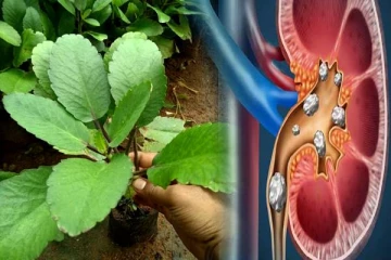 சிறுநீரக கற்களை கரைக்கும் ரணகள்ளி- யாரெல்லாம் சாப்பிடலாம்?