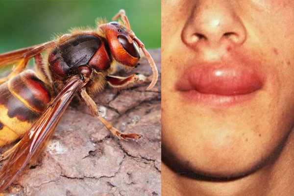 தேனீ அல்லது குளவி கொட்டினால் என்ன செய்வது? பலரும் அறியாதது | What To Do If You Get Stung By A Bee Or Wasp தேனீ அல்லது குளவி கொட்டினால் என்ன செய்வது? பலரும் அறியாதது | What To Do If You Get Stung By A Bee Or Wasp