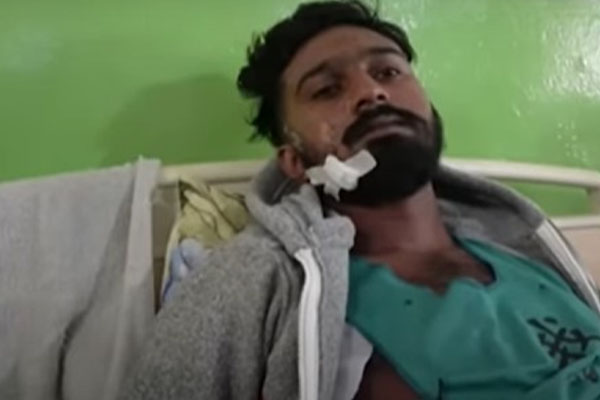 யானைகளின் நடமாட்டம் இருப்பதாக சுற்றுலா வழிகாட்டி தன்னிடம் தெரிவிக்கவில்லை; படுகாயமடைந்த இளைஞன் புகார் | Complaint Of Seriously Injured Youth