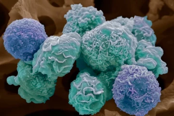 இந்த ஒரு பழக்கத்தை விட்டாலே போதும்: பிரித்தானியர்கள் மரணத்தை பெருமளவில் தவிர்க்கலாம்...