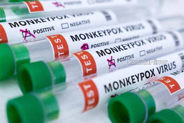 கனடாவின் குரங்கம்மை நிலவரம் | Monkeypox Infections Decreasing Canada Phac