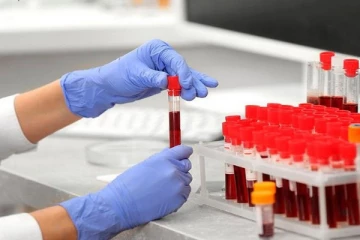 வவுனியாவில் நான்கு பேருக்கு கோவிட்-19 தொற்று உறுதி