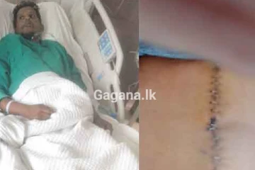 ආහාර ඇනවුම ප්‍රමාද වූවා කියා, ලාංකිකයෙකුට ලැබුණු අතිශය අමානුෂික දඩුවම - (VIDEO)