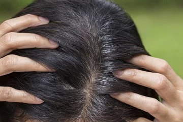 இளநரை பிரச்சனையால் அவஸ்தையா? இதனை தடுக்க உதவும் சில அற்புத குறிப்புகள் !!