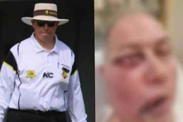 கிரிக்கெட் போட்டியில் விபரீதம் - பேட்ஸ்மேன் அடித்த பந்தால் கொடூரமாக மாறிய நடுவரின் முகம்