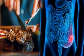 இறைச்சி அதிகமாக சாப்பிட்டால் பெருங்குடல் புற்றுநோய் வருமா? ஆய்வின் வெளிச்சம்