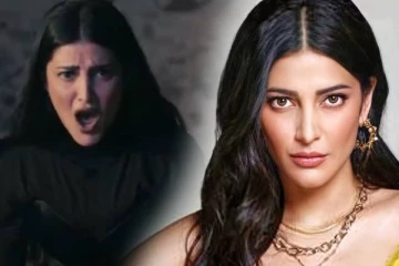 நான் என்ன செய்தால் உங்களுக்கு என்ன!! பிளாஸ்டிக் சர்ஜரி குறித்து கத்திய கமல் மகள் ஸ்ருதி.