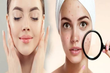 Skincare Tips : முகத்தில் உள்ள கரும்புள்ளிகளை குறைக்க எளிய இயற்கை வழிகள்!