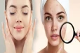 Skincare Tips : முகத்தில் உள்ள கரும்புள்ளிகளை குறைக்க எளிய இயற்கை வழிகள்!