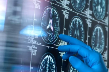 வெளிநாட்டில் சாப்பிட்ட உணவு: மூளையில் புழுக்களுடன் திரும்பிவந்த பெண்