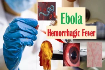 Ebola symptoms: எபோலா வைரஸ் என்றால் என்ன? இந்த அறிகுறிகள் இருந்தால் ஜாக்கிரதை!