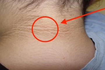 கழுத்தை சுற்றி படர்ந்திருக்கும் கருமையை போக்க வேண்டுமா? இதோ சூப்பரான டிப்ஸ்