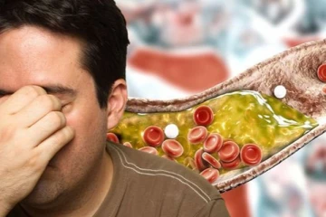 Cholesterol-ஐ குறைக்க மாத்திரை சாப்பிடலாமா?