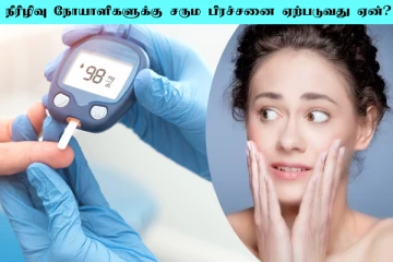 நீரிழிவு நோயாளிகளுக்கு ஏற்படும் தோல் பிரச்சனை... இதை கட்டாயம் செய்யனுமாம்