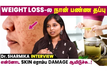 உடல் எடையை குறைக்கும் போது நான் பண்ண தவறு! மருத்துவர் ஷர்மிகாவின் பேட்டி