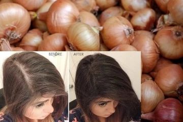 வெங்காயச் சாறு தேய்த்தால் முடி உதிராது என்பது உண்மையா? வாங்க தெரிந்து கொள்ளலாம்