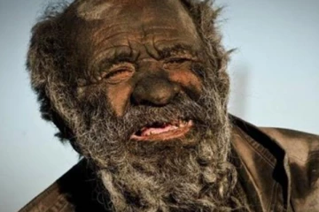 ලොව අපිරිසිදුම මිනිසා මිය යයි.. (PHOTOS)